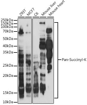 Pan-Succinyl-K Rabbit pAb
