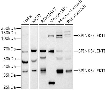 SPINK5 / LEKTI Rabbit mAb