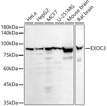 EXOC3 Rabbit mAb