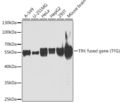 TRK fused gene (TFG) Rabbit pAb