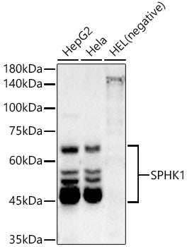 SPHK1 Rabbit mAb