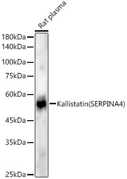 Kallistatin (SERPINA4) Rabbit mAb