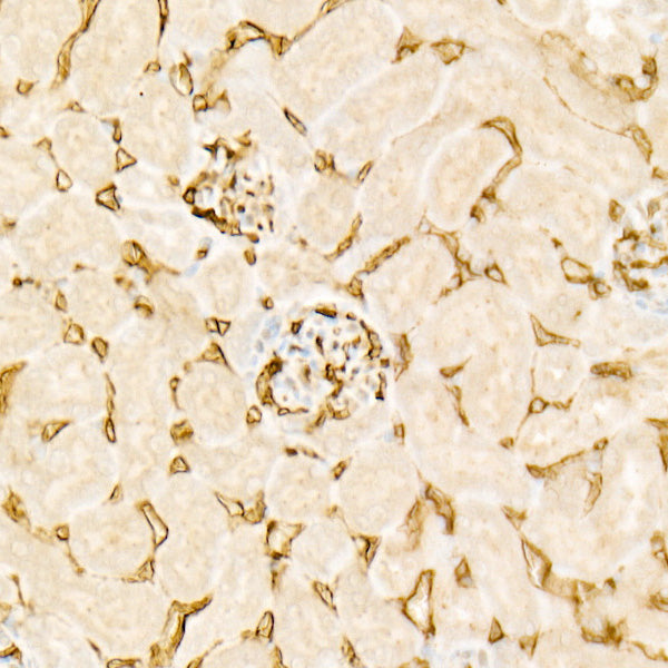 Endomucin Rabbit mAb