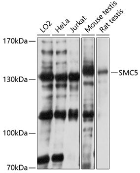 SMC5 Rabbit pAb