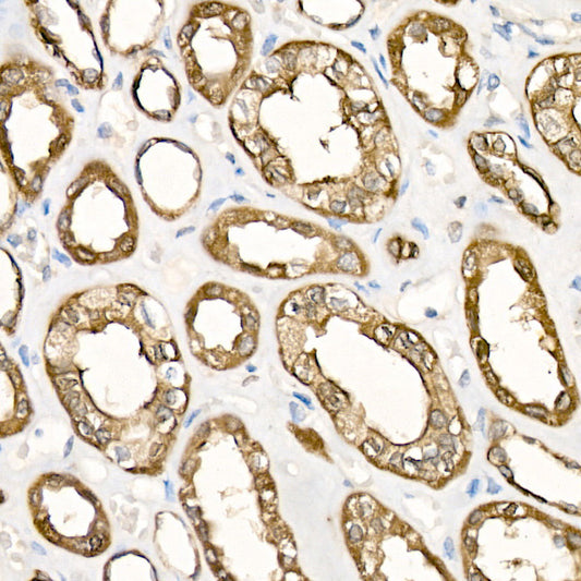 TNFR2/TNFRSF1B Rabbit mAb