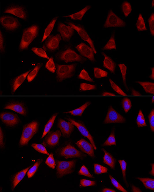 PKC alpha Rabbit mAb