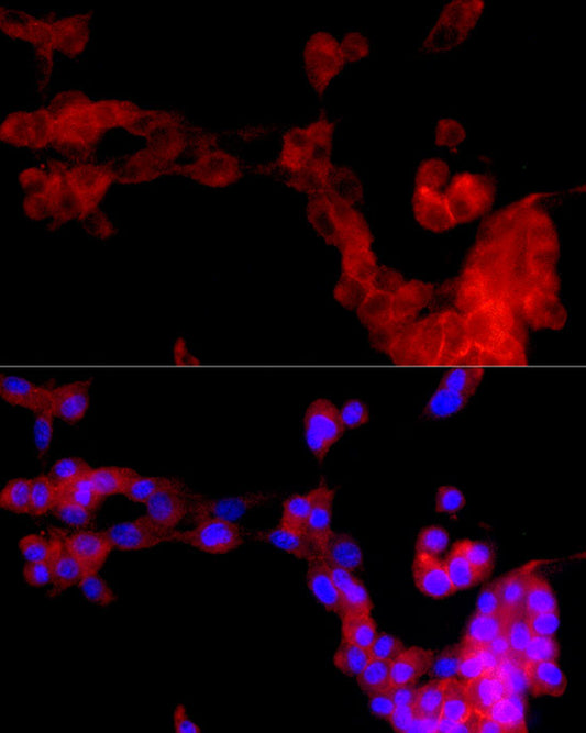uPAR/U-PAR Rabbit mAb
