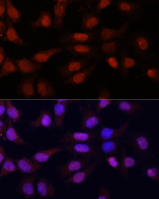 N5-Methylcytidine Rabbit pAb
