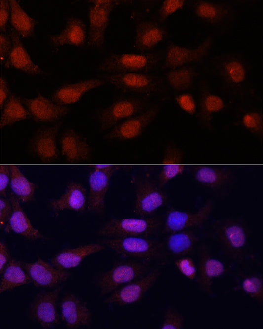 N5-Methylcytidine Rabbit pAb