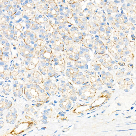 Plectin Rabbit mAb