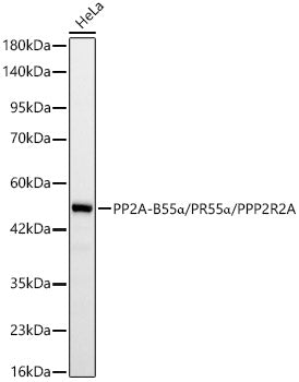 PP2A-B55α/PR55α/PPP2R2A Rabbit mAb