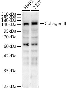Collagen II Rabbit pAb