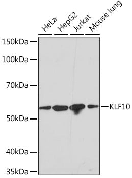 KLF10 Rabbit mAb