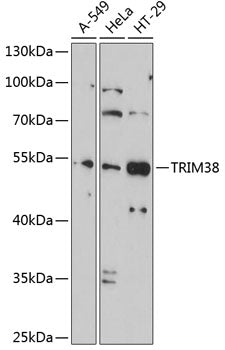 TRIM38 Rabbit pAb