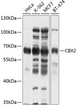 CBX2 Rabbit pAb