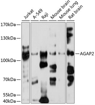AGAP2 Rabbit pAb