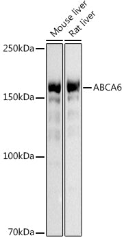 ABCA6 Rabbit pAb