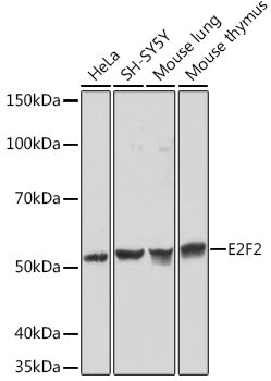 E2F2 Rabbit mAb