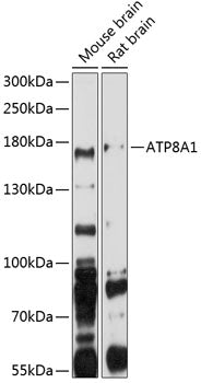 ATP8A1 Rabbit pAb