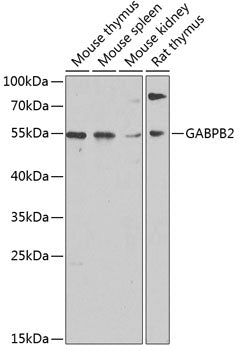 GABPB2 Rabbit pAb