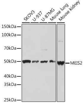 MEIS2 Rabbit mAb