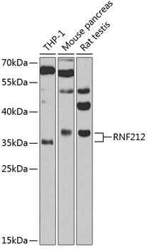RNF212 Rabbit pAb