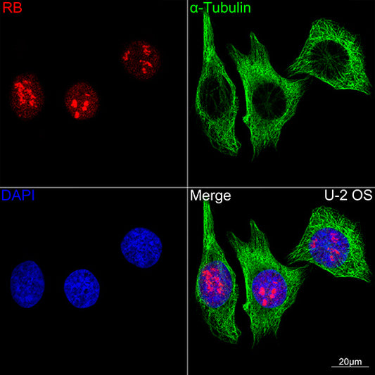 RB Rabbit mAb