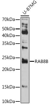 RAB8B Rabbit pAb