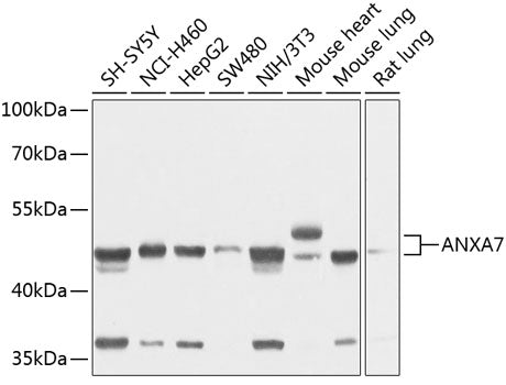 ANXA7 Rabbit pAb