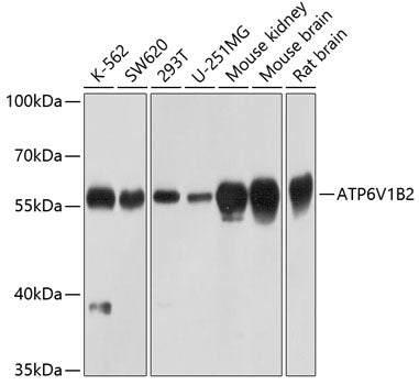 ATP6V1B2 Rabbit pAb