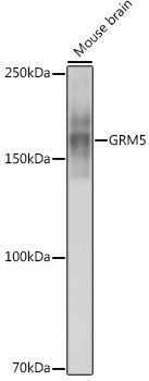 GRM5 Rabbit mAb