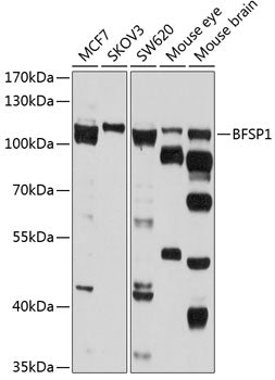 BFSP1 Rabbit pAb