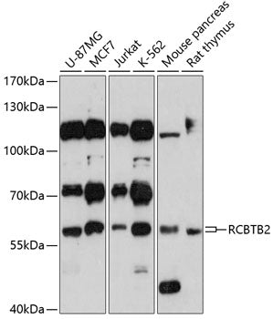 RCBTB2 Rabbit pAb
