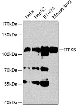 ITPKB Rabbit pAb