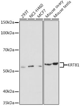 KRT81 Rabbit pAb