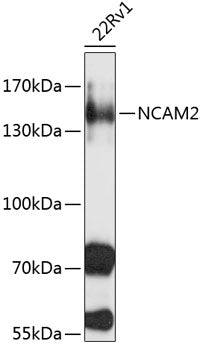 NCAM2 Rabbit pAb