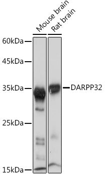 DARPP32 Rabbit mAb