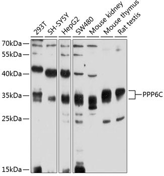PPP6C Rabbit pAb