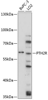 PTH2R Rabbit pAb