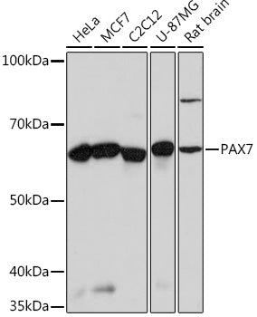 PAX7 Rabbit mAb