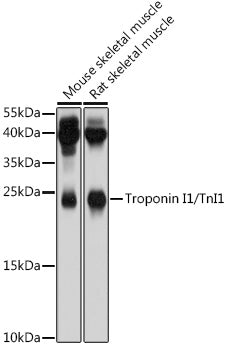 Troponin I1/TnI1 Rabbit pAb