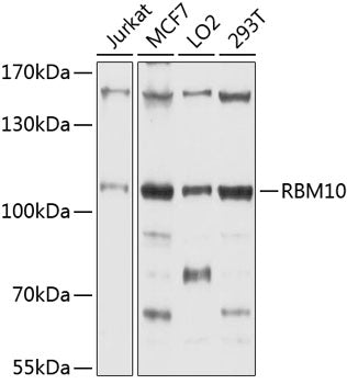 RBM10 Rabbit pAb