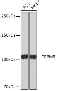 TRPM8 Rabbit mAb