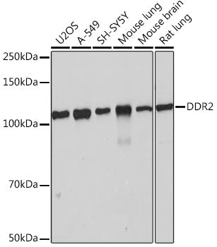DDR2 Rabbit mAb