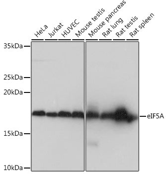 eIF5A Rabbit mAb