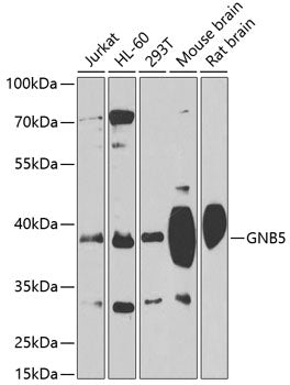 GNB5 Rabbit pAb