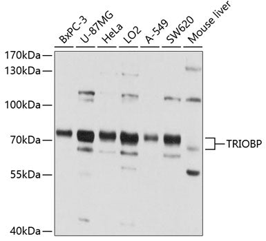 TRIOBP Rabbit pAb