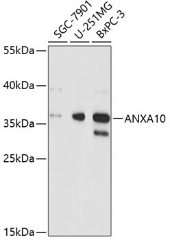 ANXA10 Rabbit pAb