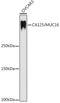 CA125 / MUC16 Rabbit mAb
