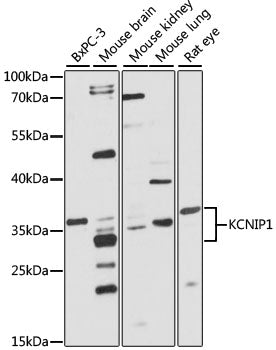 KCNIP1 Rabbit pAb